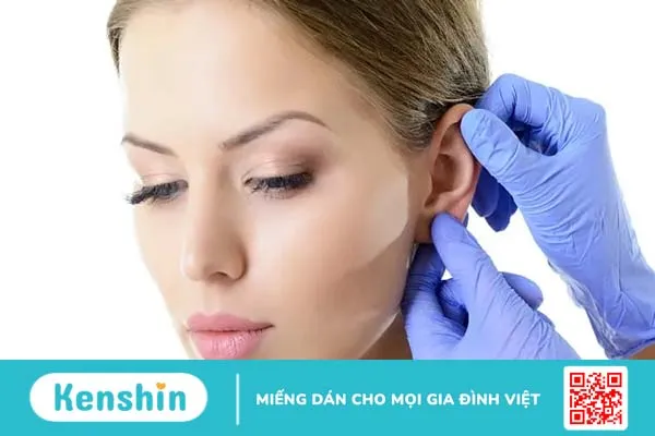 Những thông tin cần biết về phẫu thuật tai thẩm mỹ