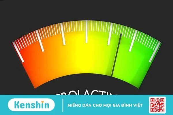 Những thông tin hữu ích về xét nghiệm prolactin