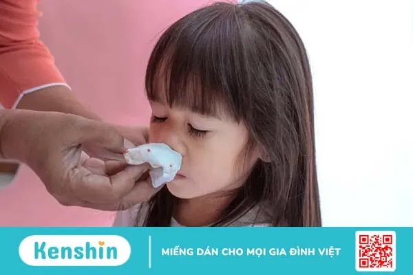 Những thông tin về bệnh xuất huyết giảm tiểu cầu ở trẻ em