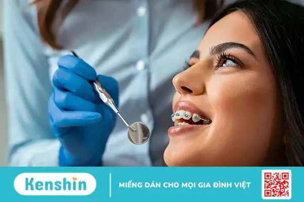 Niềng răng có phải nhổ răng không? Khi nào cần nhổ, khi nào không?