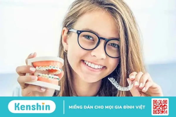 Niềng răng thưa mất bao lâu? Phương pháp, quy trình và kinh nghiệm