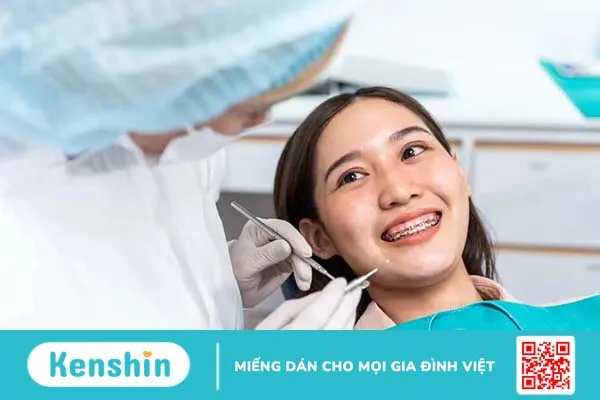 Niềng răng thưa mất bao lâu? Phương pháp, quy trình và kinh nghiệm