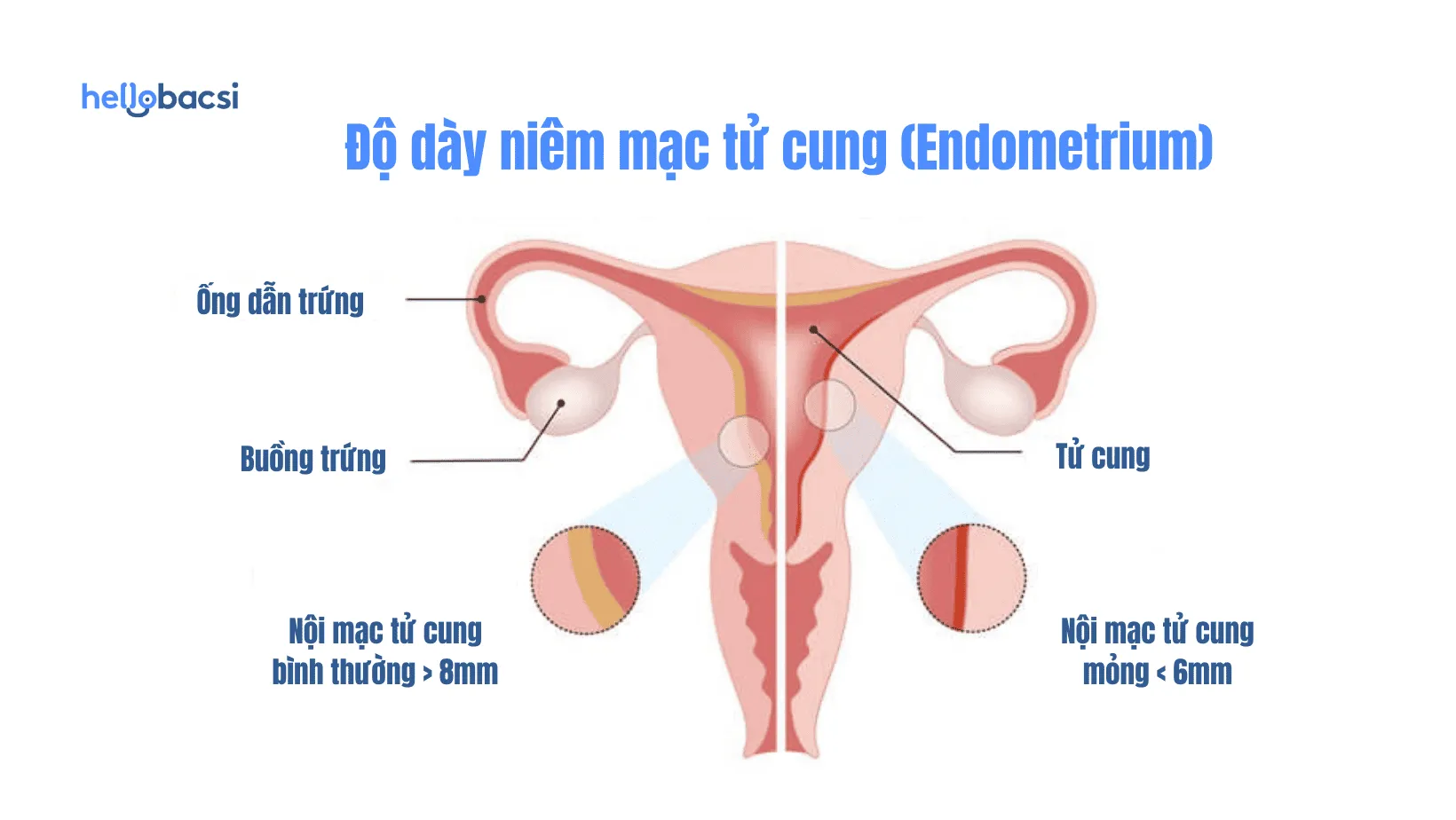 Nội mạc tử cung là gì? Cấu tạo, vị trí và chức năng