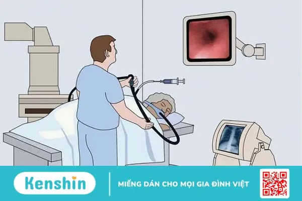 Nội soi mật tụy ngược dòng (ERCP)