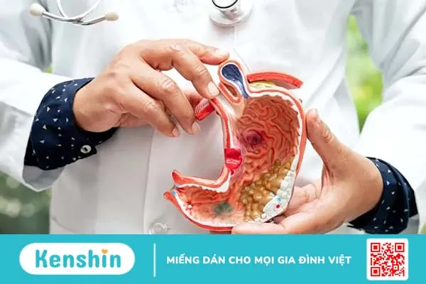 Nóng rát dạ dày là bệnh gì? Nguyên nhân và cách chữa dứt điểm tại nhà