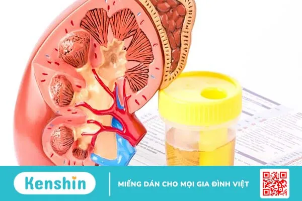 Nước tiểu có bọt là bệnh gì và cách khắc phục