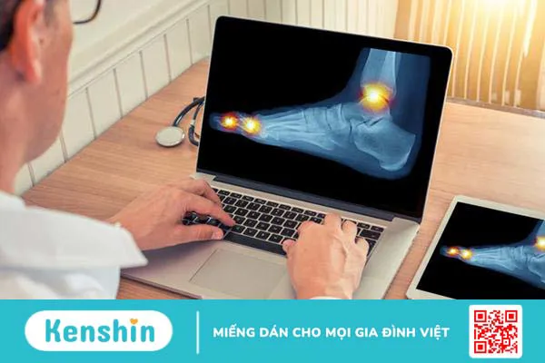 Phác đồ điều trị gout và những cập nhật trong điều trị gout