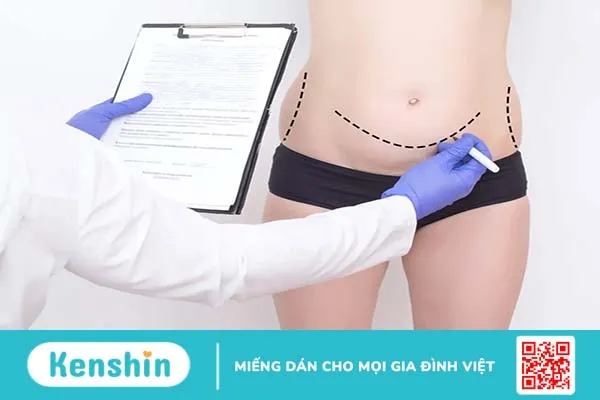 Phẫu thuật thẩm mỹ xóa sẹo và những điều bạn cần biết