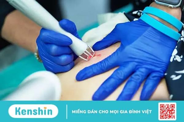 Phẫu thuật thẩm mỹ xóa sẹo và những điều bạn cần biết