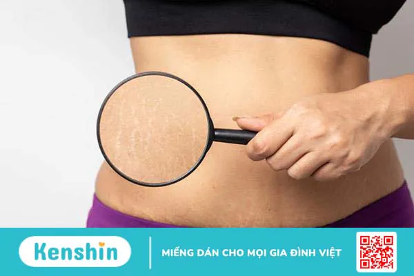 Phụ nữ sinh mổ ăn ổi được không? Bật mí cách ăn ổi sau sinh mổ đúng