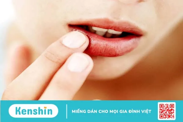 Phun môi có được ăn chuối không? Ăn gì và kiêng gì để nhanh lên màu đẹp