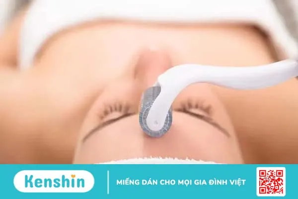 Phương pháp trị sẹo rỗ đáy vuông: Nỗi ám ảnh sau mụn