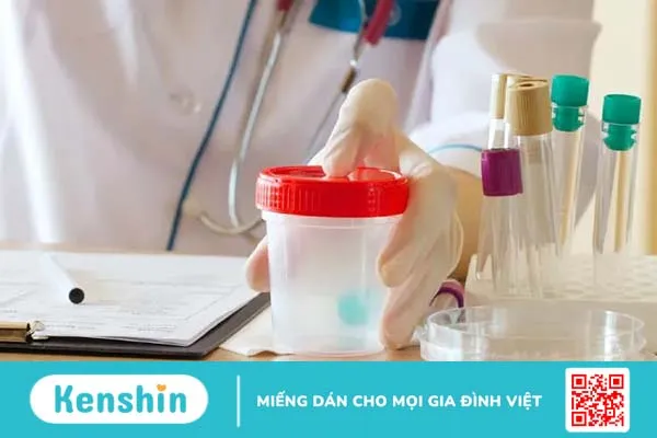 Phương pháp xét nghiệm nước tiểu có giúp chẩn đoán bệnh chính xác?