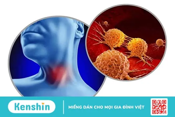 Quan hệ bằng miệng xong đau họng là bị gì? Cẩn thận với 6 bệnh xã hội