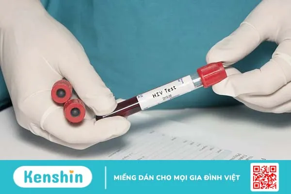 Quan hệ với người nhiễm HIV bao lâu thì bị bệnh?