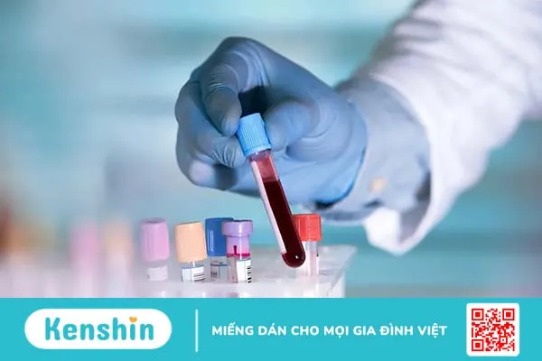 Quy trình và tiêu chuẩn chẩn đoán rối loạn lipid máu