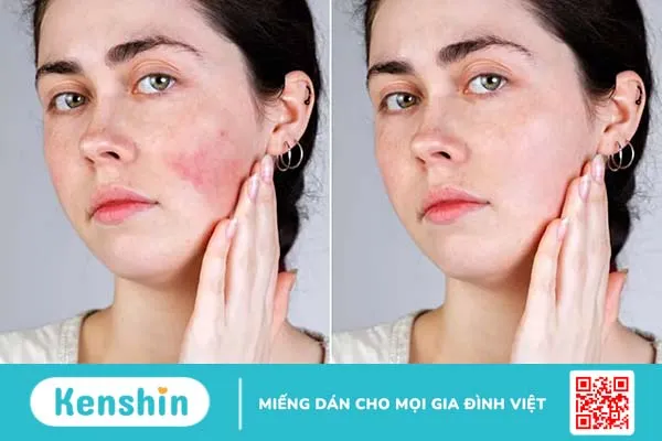 Review các loại serum phục hồi da tốt hiện nay