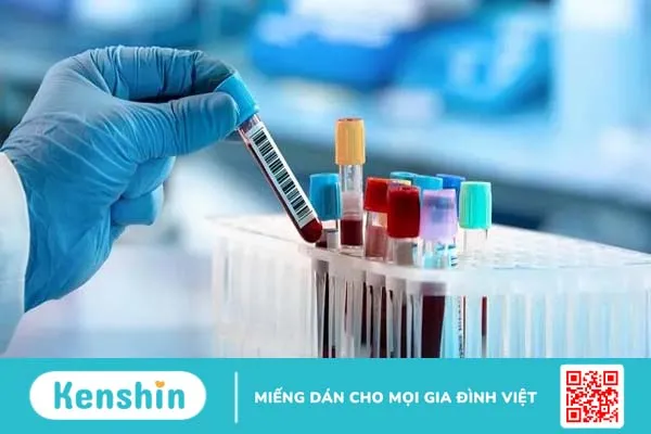 Rối loạn mỡ máu