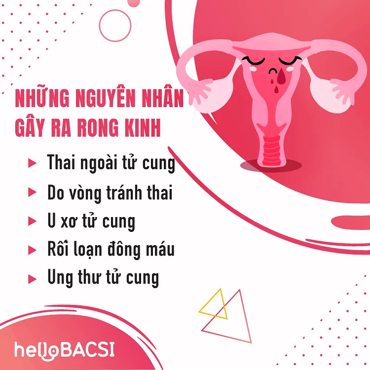 Rong kinh là gì? Cách điều trị và phòng ngừa kinh nguyệt kéo dài