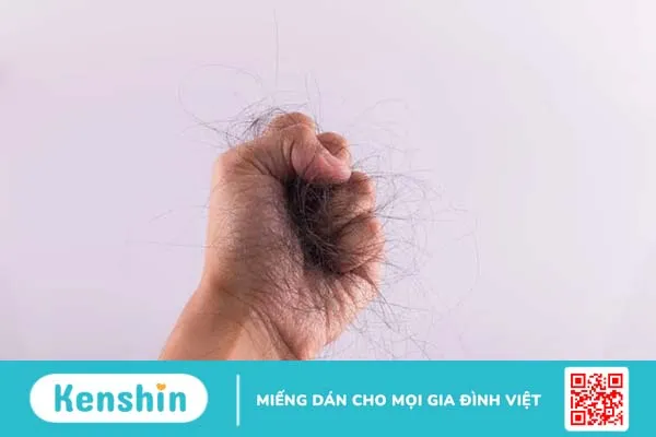 Rụng tóc nhiều ở nam tuổi dậy thì – Trẻ có thể bị hói đầu sớm?