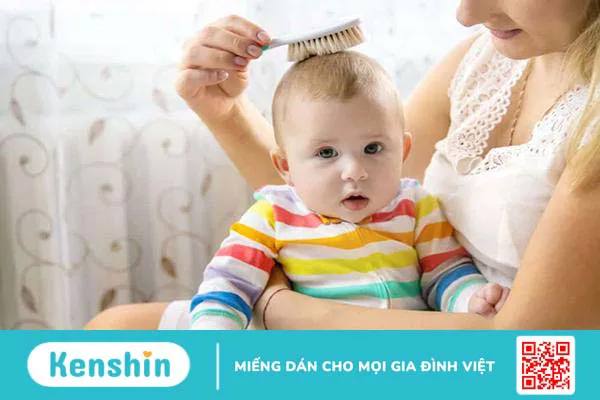 Rụng tóc vành khăn ở trẻ nhỏ là gì, trẻ có nguy cơ hói vĩnh viễn không?