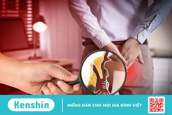 Sa búi trĩ uống thuốc gì? Điểm danh các loại thuốc điều trị bệnh trĩ phổ biến