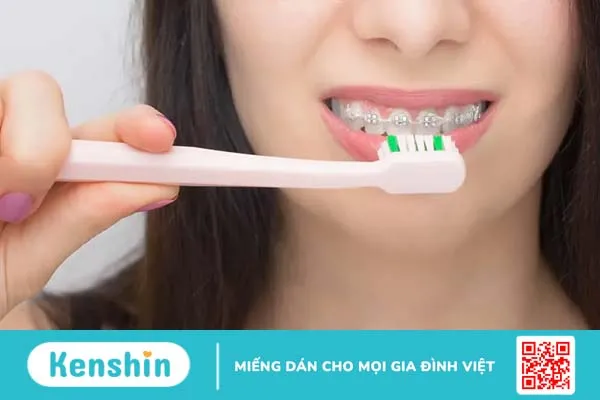 Sáp nha khoa là gì? Dùng sáp chỉnh nha đúng cách, giảm cơn đau hiệu quả