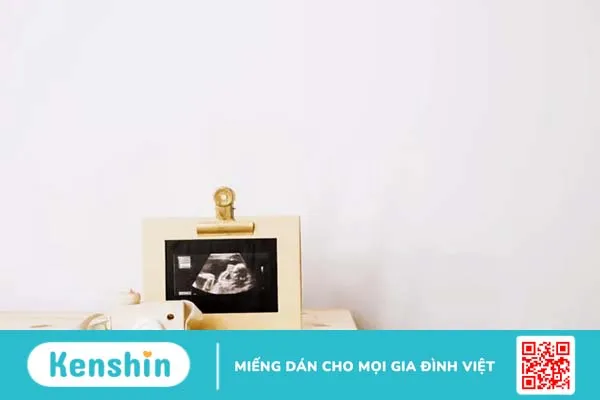 Siêu âm 4D là gì? Mách bạn các mốc siêu âm thai 4D quan trọng