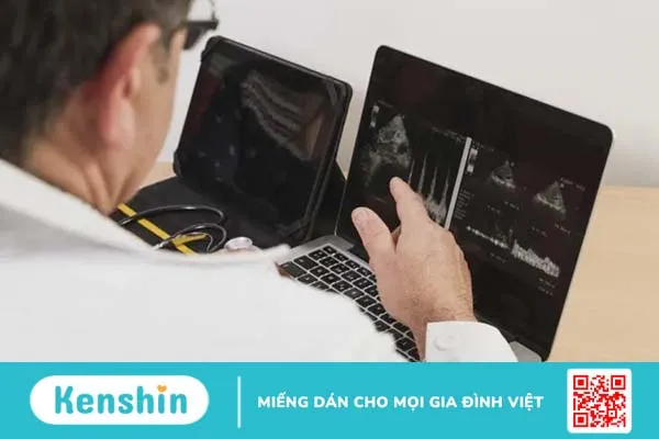 Siêu âm 4D là gì? Mách bạn các mốc siêu âm thai 4D quan trọng