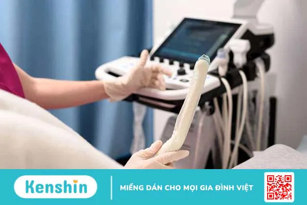 Siêu âm canh trứng tăng cơ hội thụ thai: Bạn cần biết những gì?