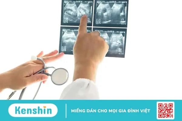 Siêu âm màng phổi và những thông tin cần biết