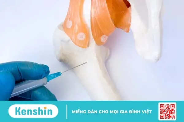 Sinh thiết: Xét nghiệm giúp bạn chẩn đoán ung thư