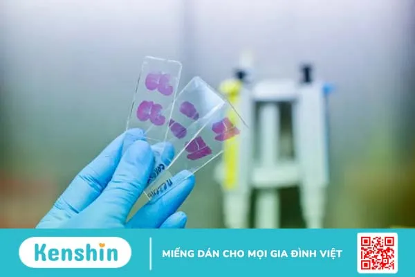 Sinh thiết: Xét nghiệm giúp bạn chẩn đoán ung thư