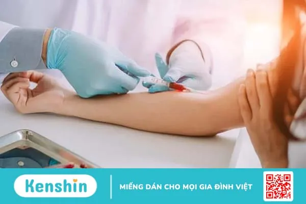 Số lượng hồng cầu: Xét nghiệm đánh giá tình trạng sức khỏe