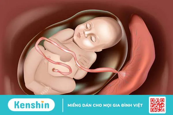 Sót nhau thai sau sinh: Nhận biết triệu chứng, xử lý kịp thời