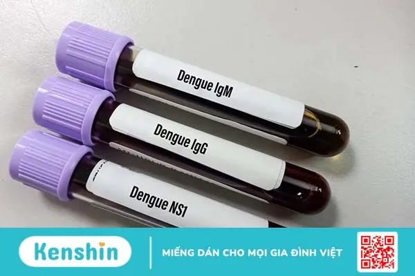 Sốt xuất huyết có bị lại không? Bị mấy lần trong đời, có nguy hiểm không?