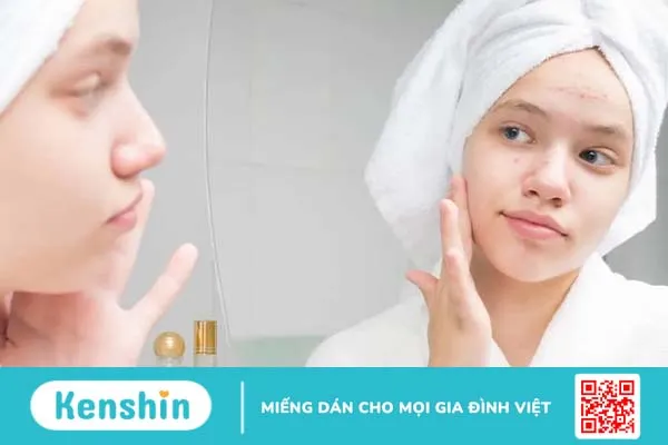 Sự thật về 10 tác hại của trà sữa: Người dùng đừng làm ngơ!