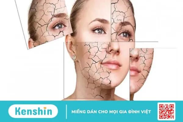 Sữa ong chúa có tác dụng gì? 13 công dụng và cách sử dụng sữa ong chúa