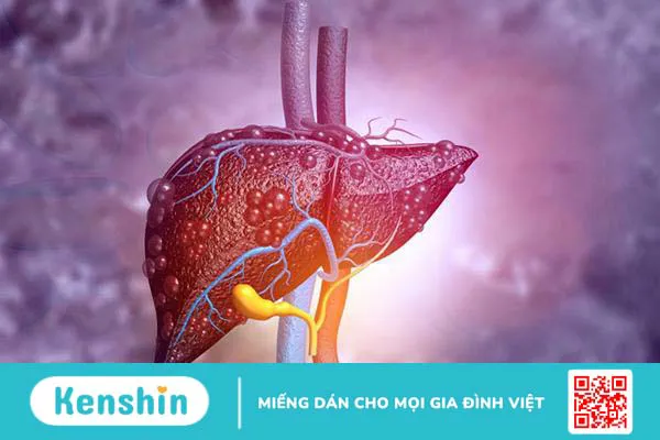 Tác dụng của cà gai leo và những lưu ý gì khi sử dụng?