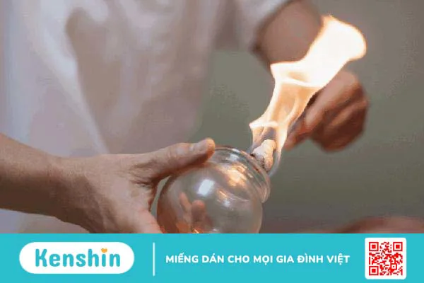 Tác dụng của giác hơi khi bạn dùng đúng cách