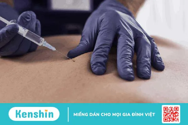 Tác hại của viêm cột sống