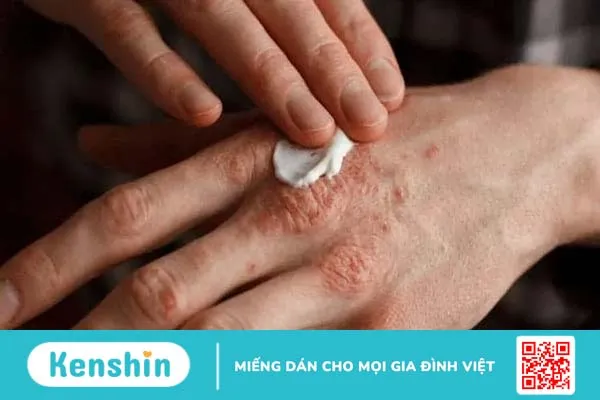 Tác hại khôn lường của việc hút thuốc lá đối với làn da