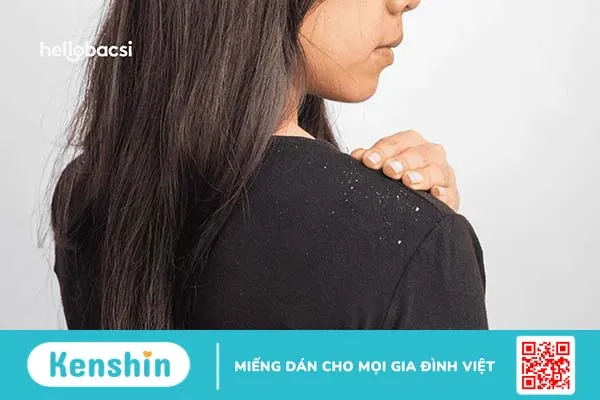 Tại sao gội đầu xong vẫn có gàu, vẫn bị ngứa?