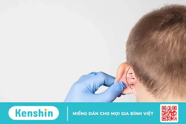 Tai súp lơ là gì? Nguyên nhân, triệu chứng, cách điều trị và phòng ngừa