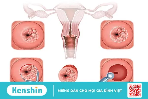 Tầm soát ung thư, những điều cần lưu ý!