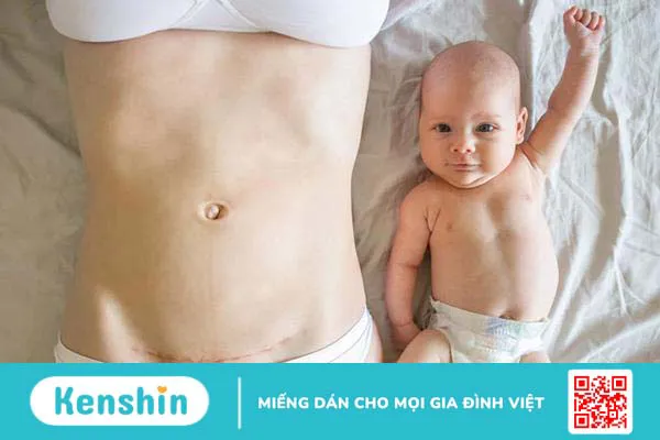 Táo bón sau sinh mổ: Điểm mặt 10 nguyên nhân thường gặp!