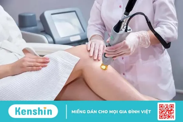 Tất tần tật về các phương pháp triệt lông