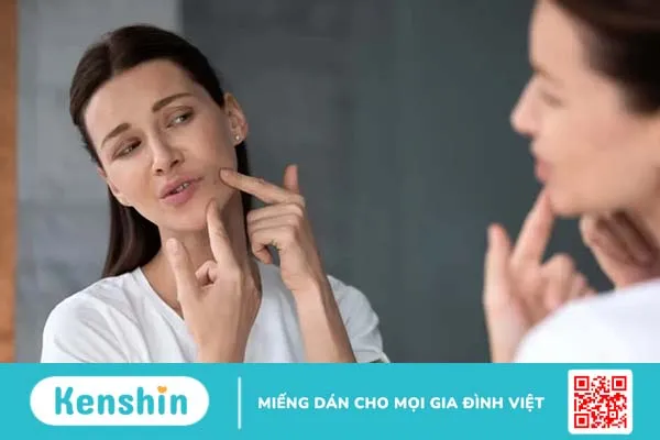 Tẩy nốt ruồi bao lâu thì bong vảy và cách chăm sóc để mau lành?