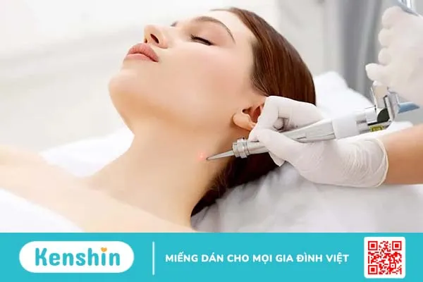 Tẩy nốt ruồi bao nhiêu tiền?