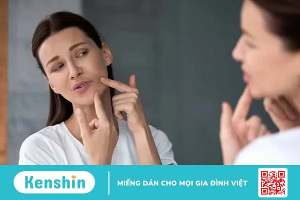 Tẩy nốt ruồi kiêng ăn gì và kiêng trong bao lâu để hạn chế sẹo?